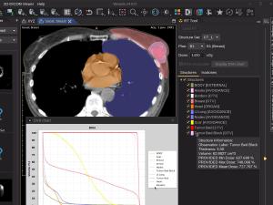 Display DICOM RT (Radiotherapy)