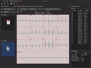 Display DICOM Waveforms
