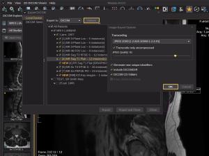 Exporting DICOM