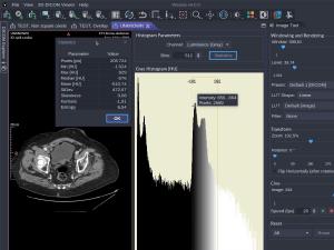 Image Histogram