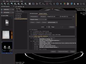Importing DICOM