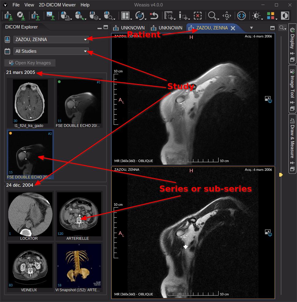 DICOM EXplorer