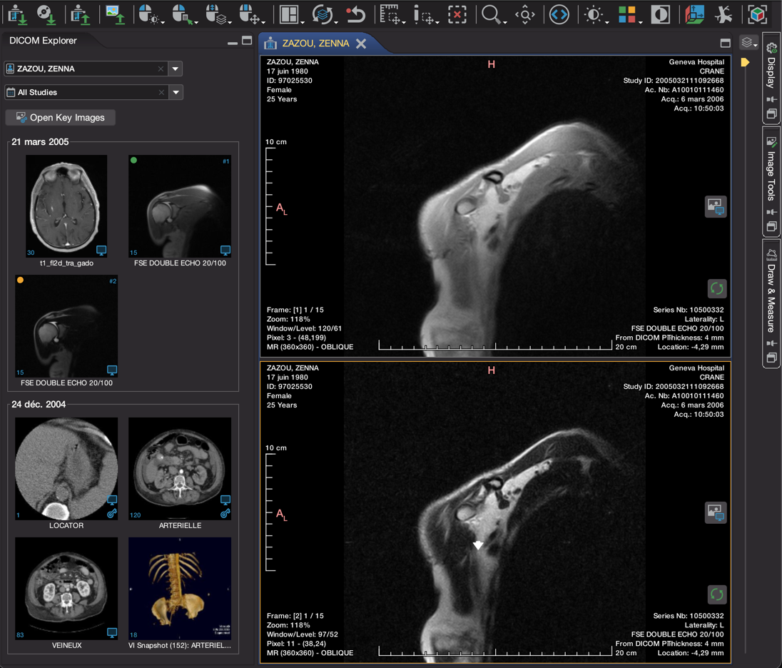 DICOM Explorer showing the Patient, Study and Series levels