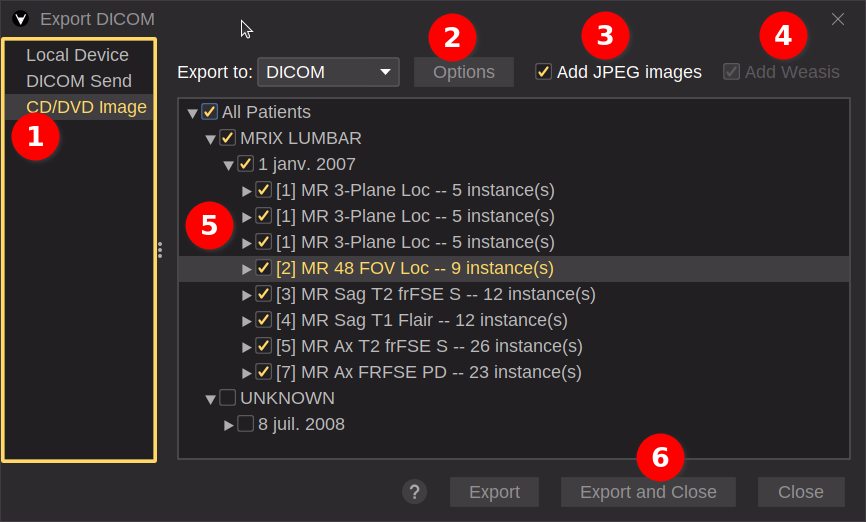Export DICOM