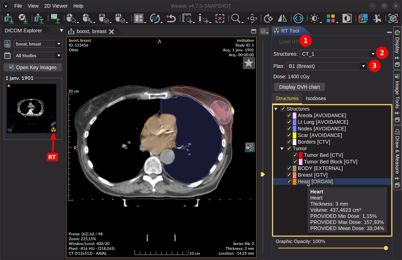 DICOM STRUCT