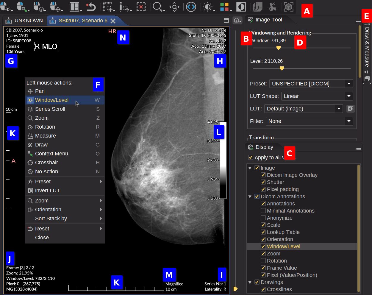 DICOM 2DViewer