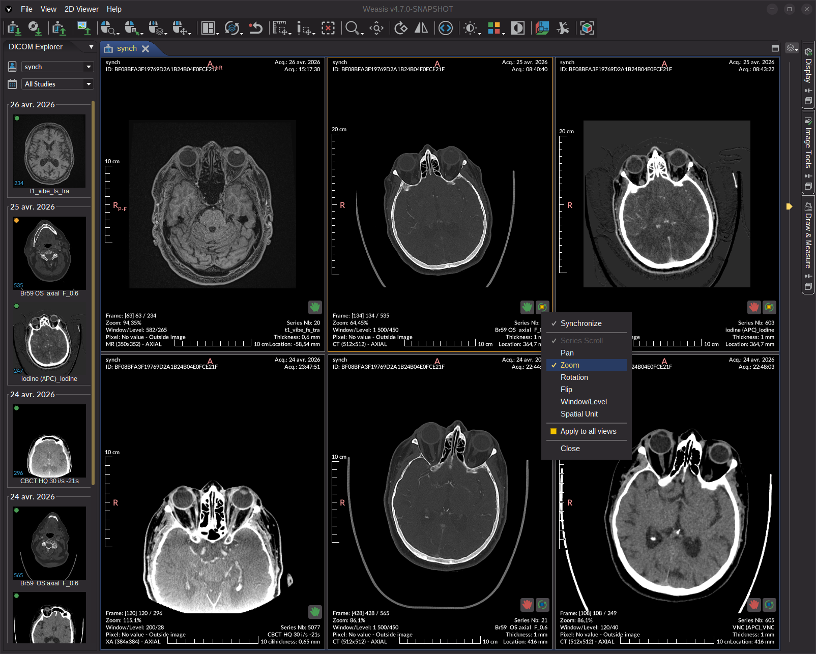 View synchronization layout