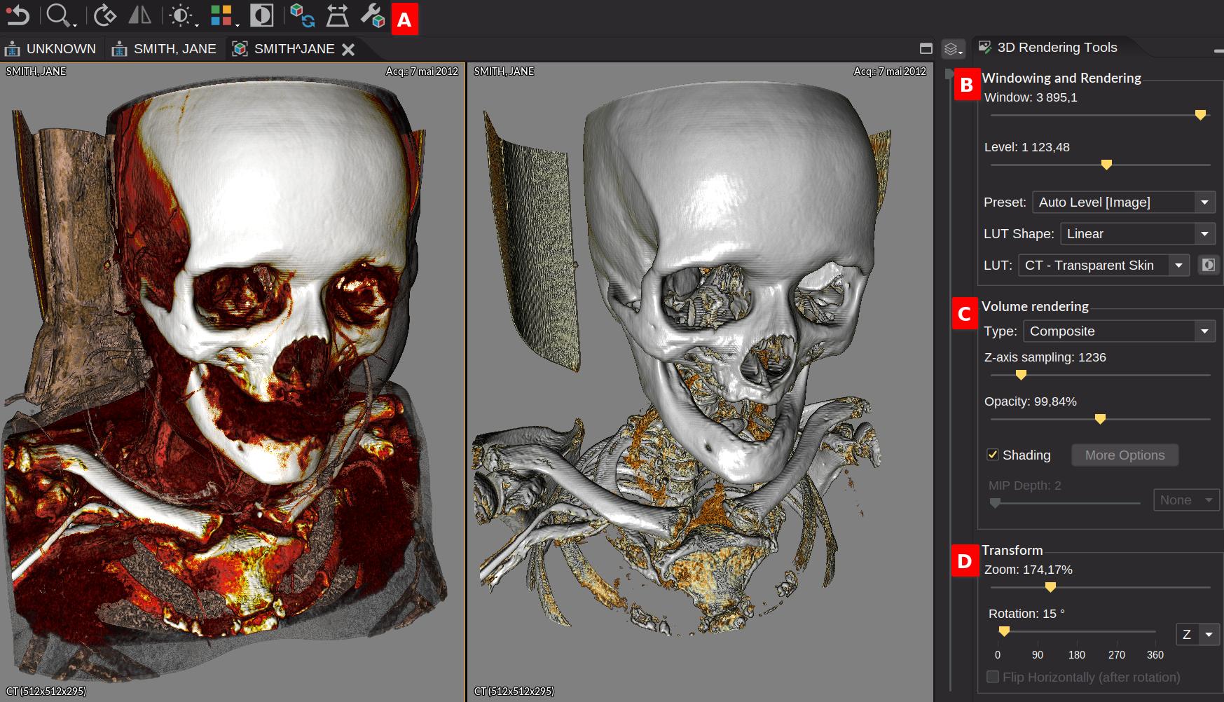 3D View