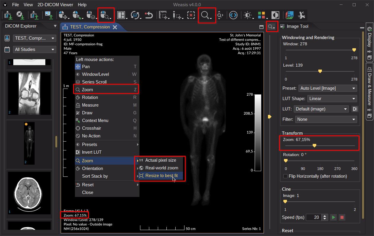 Zoom tool controls